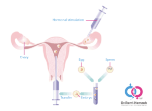undergoing IVF